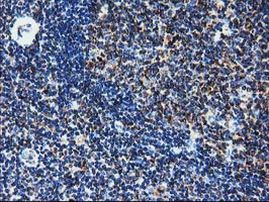 CLPP Antibody in Immunohistochemistry (Paraffin) (IHC (P))