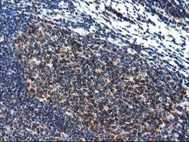 CLPP Antibody in Immunohistochemistry (Paraffin) (IHC (P))