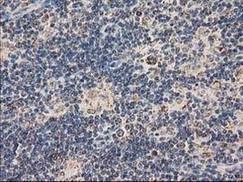 CLPP Antibody in Immunohistochemistry (Paraffin) (IHC (P))