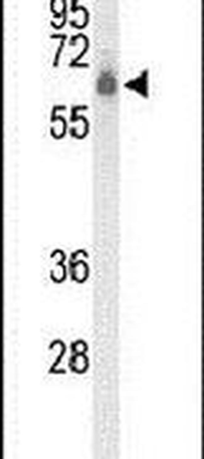 CLPTM1L Antibody in Western Blot (WB)