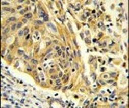 Clathrin Light Chain A Antibody in Immunohistochemistry (IHC)