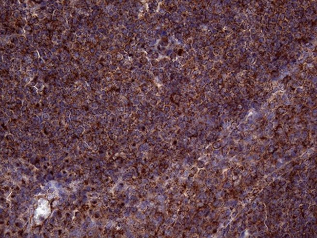 CLTA Antibody in Immunohistochemistry (Paraffin) (IHC (P))