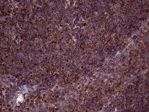 CLTA Antibody in Immunohistochemistry (Paraffin) (IHC (P))