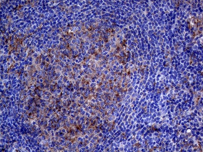 CLTA Antibody in Immunohistochemistry (Paraffin) (IHC (P))
