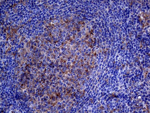 CLTA Antibody in Immunohistochemistry (Paraffin) (IHC (P))