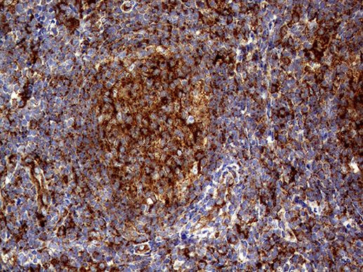 CLTA Antibody in Immunohistochemistry (Paraffin) (IHC (P))