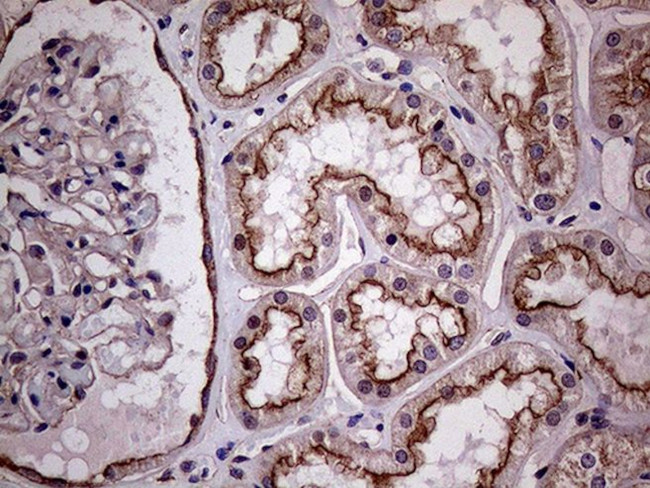 CLTA Antibody in Immunohistochemistry (Paraffin) (IHC (P))