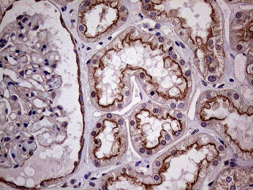 CLTA Antibody in Immunohistochemistry (Paraffin) (IHC (P))