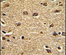 CLUAP1 Antibody in Immunohistochemistry (IHC)