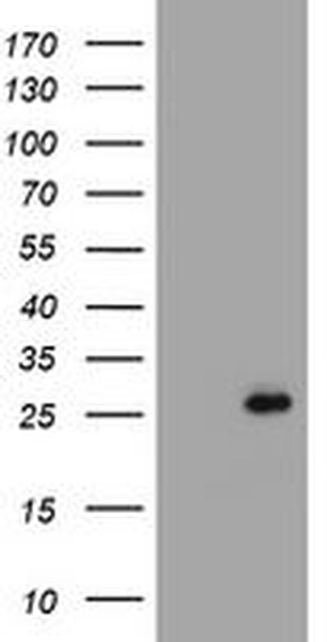 CMPK1 Antibody in Western Blot (WB)
