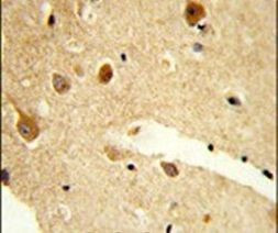 CNDP1 Antibody in Immunohistochemistry (IHC)