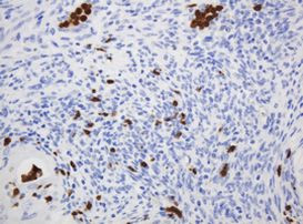 CNKSR3 Antibody in Immunohistochemistry (Paraffin) (IHC (P))