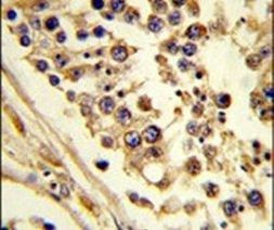 CNOT4 Antibody in Immunohistochemistry (IHC)