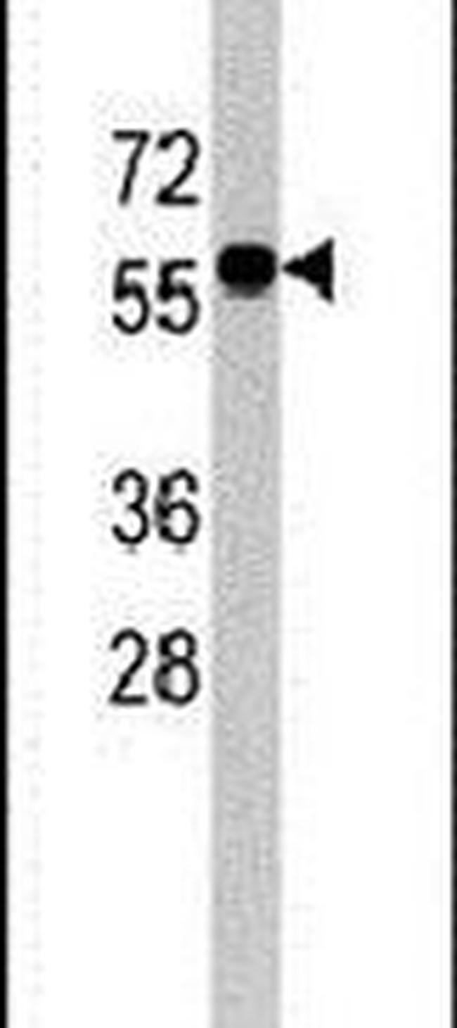 CNOT4 Antibody in Western Blot (WB)