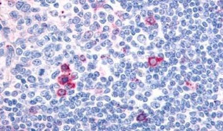CNR2 Antibody in Immunohistochemistry (Paraffin) (IHC (P))