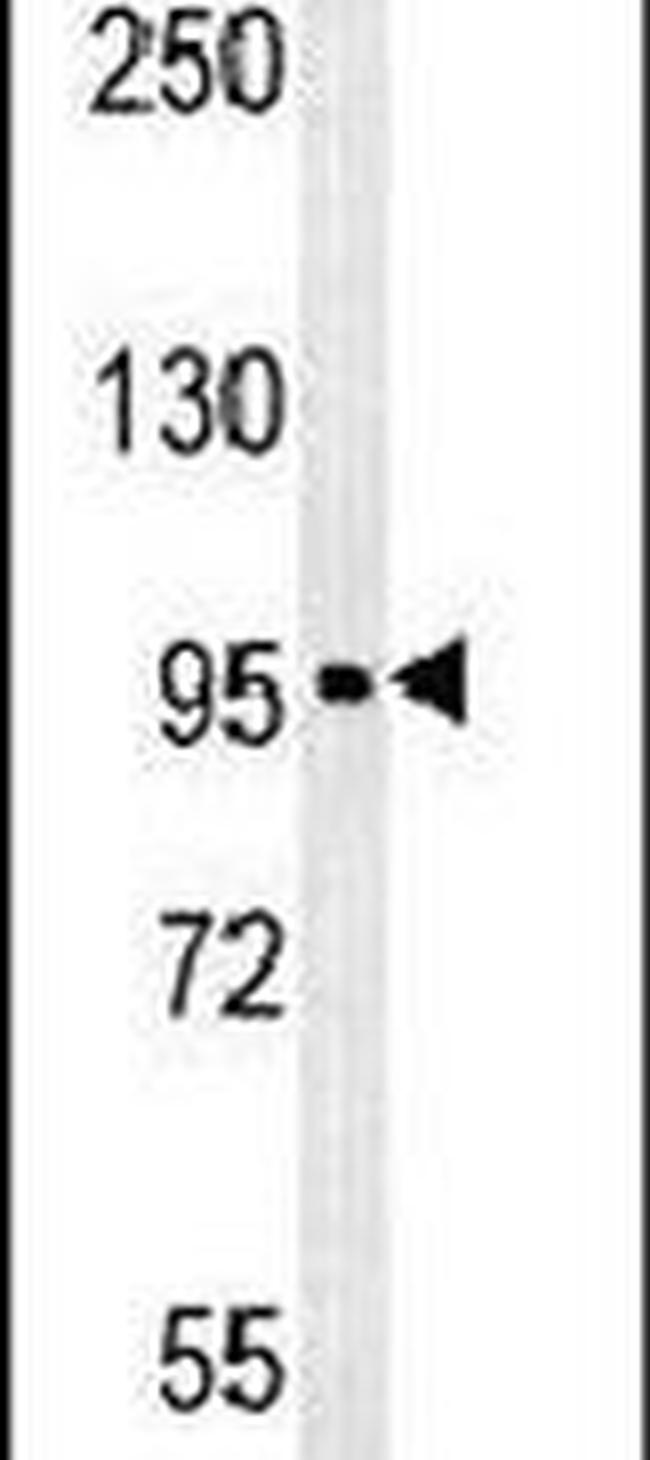 C15orf39 Antibody in Western Blot (WB)