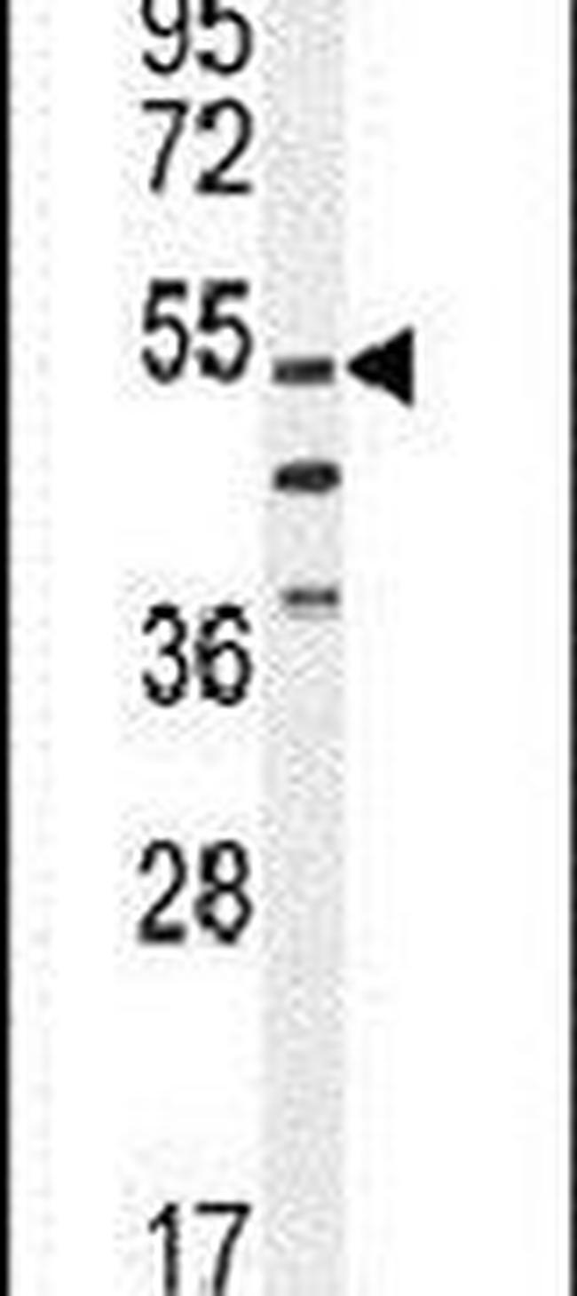VWA9 Antibody in Western Blot (WB)