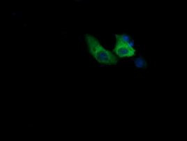 COG6 Antibody in Immunocytochemistry (ICC/IF)
