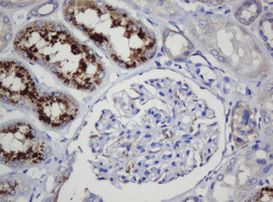 COG6 Antibody in Immunohistochemistry (Paraffin) (IHC (P))