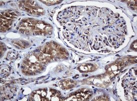 COG6 Antibody in Immunohistochemistry (Paraffin) (IHC (P))