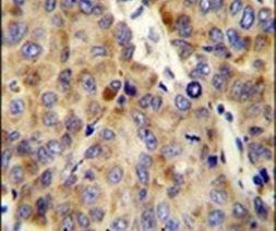 Endostatin Antibody in Immunohistochemistry (IHC)