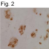 CLAC-P Antibody in Immunohistochemistry (IHC)