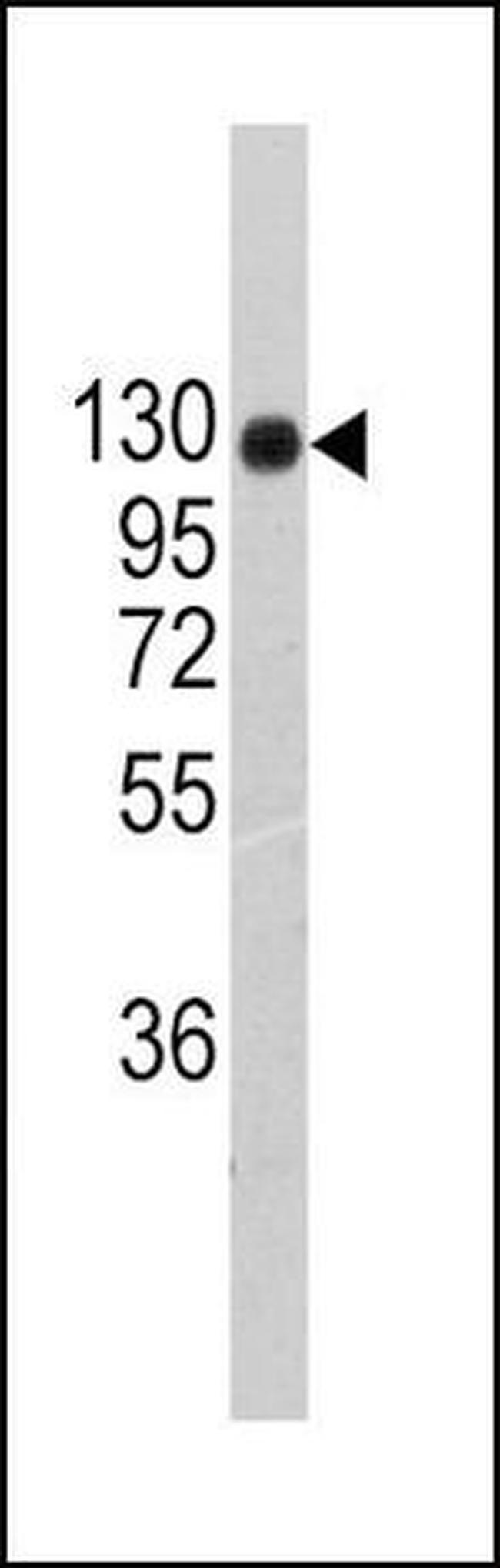 Collagen II Antibody in Western Blot (WB)