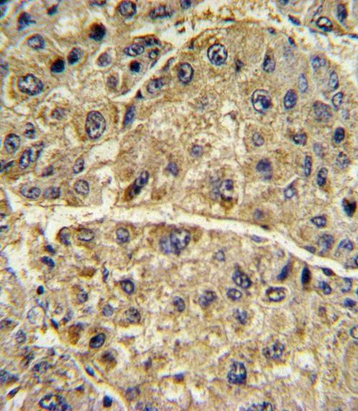 COL6A1 Antibody in Immunohistochemistry (IHC)