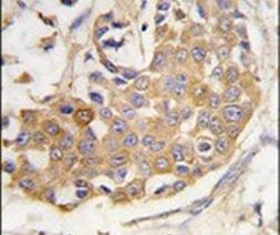 COL9A1 Antibody in Immunohistochemistry (IHC)