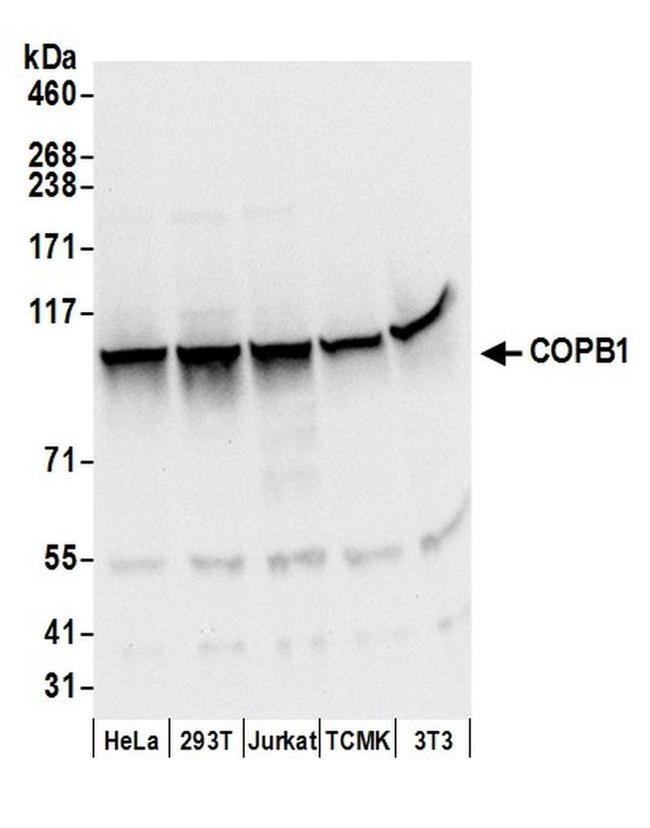 COPB1 Polyclonal Antibody (A304-724A)