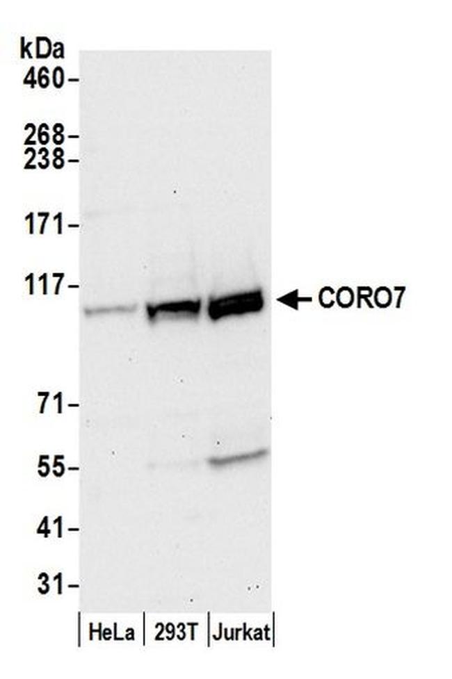 CORO7 Antibody in Western Blot (WB)