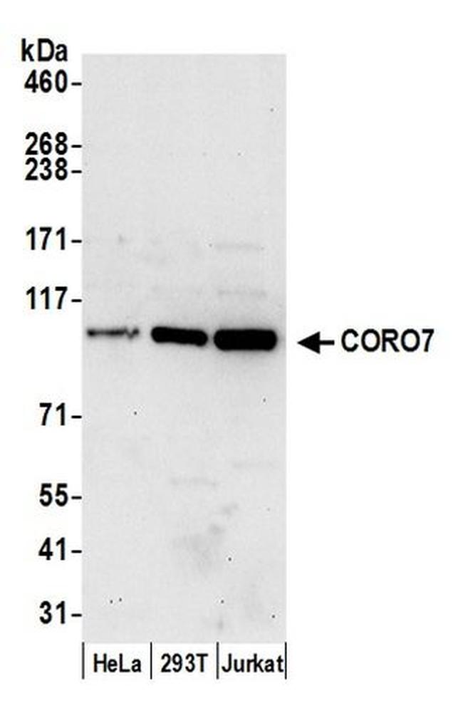 CORO7 Antibody in Western Blot (WB)