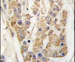 TPL2 Antibody in Immunohistochemistry (IHC)
