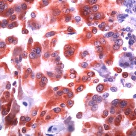 COX1 Antibody in Immunohistochemistry (IHC)