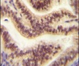CP045 Antibody in Immunohistochemistry (IHC)
