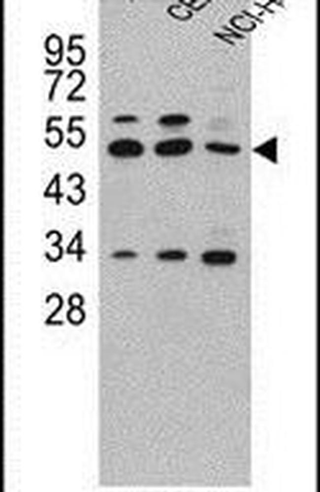 Carboxypeptidase A4 Antibody in Western Blot (WB)