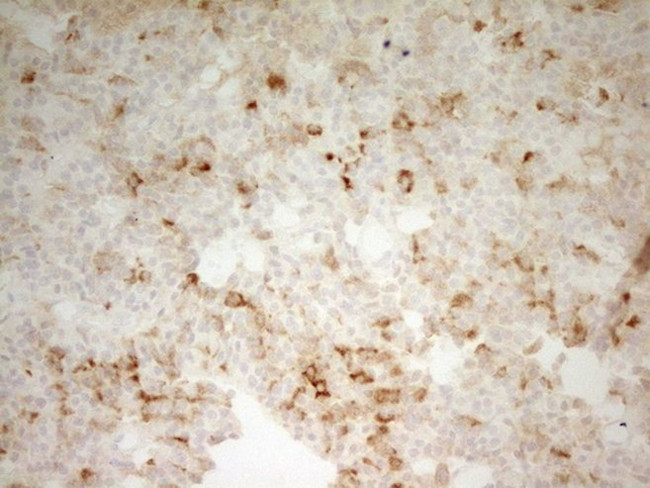 CPB2 Antibody in Immunohistochemistry (Paraffin) (IHC (P))