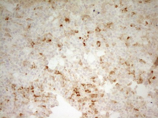 CPB2 Antibody in Immunohistochemistry (Paraffin) (IHC (P))