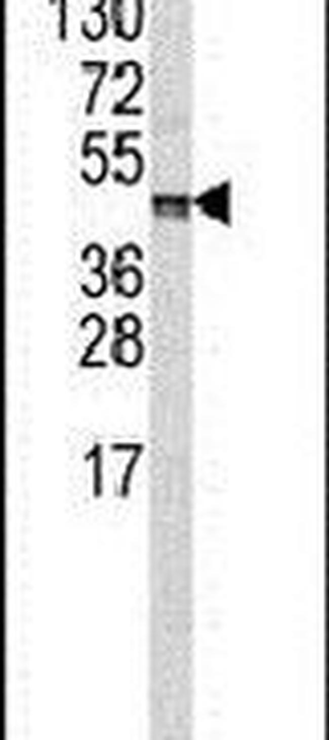 Carboxypeptidase B2 Antibody in Western Blot (WB)