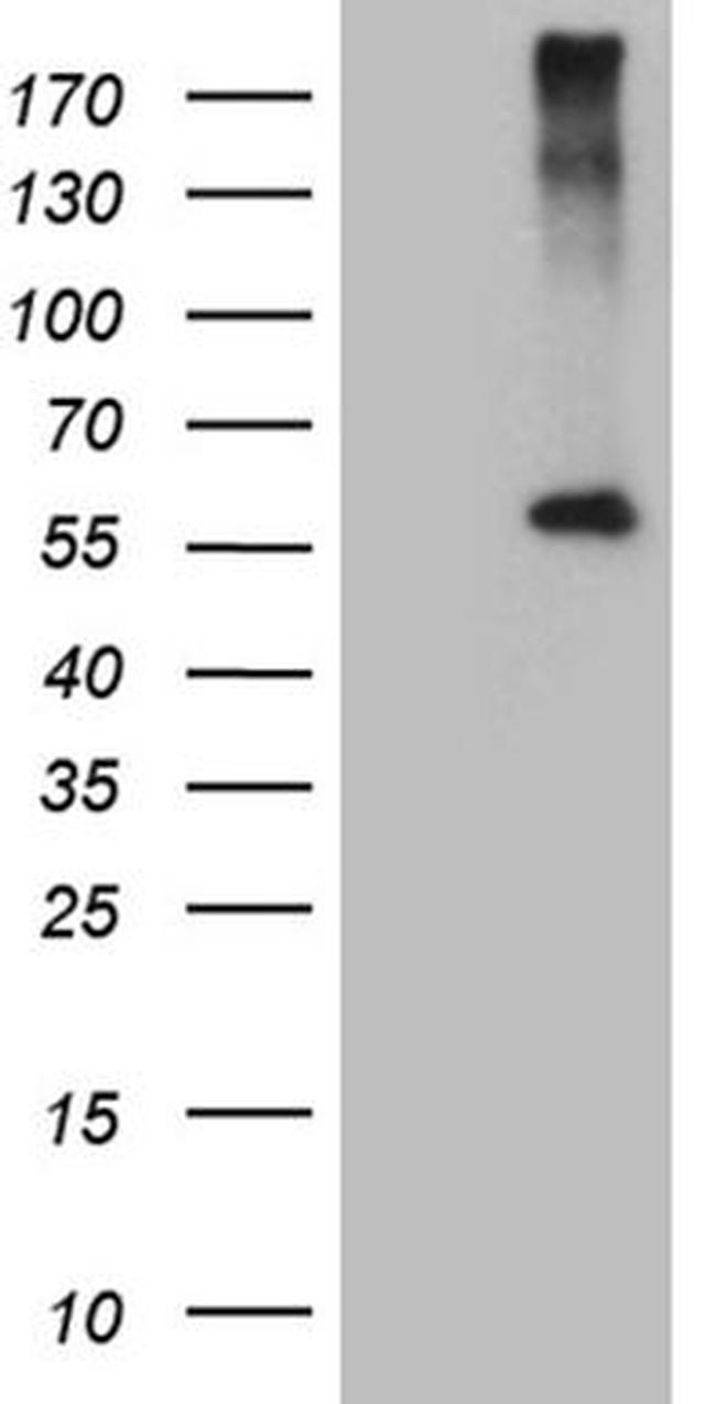 CPM Antibody in Western Blot (WB)