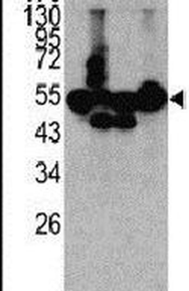 CPN1 Antibody in Western Blot (WB)