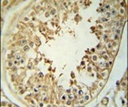 CPNE8 Antibody in Immunohistochemistry (IHC)