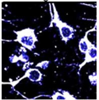 CPP Binding Protein Antibody in Immunohistochemistry (IHC)