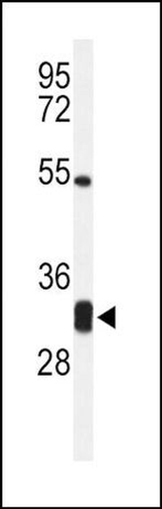 CPSF4 Antibody in Western Blot (WB)