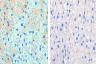CPT1A Antibody in Immunohistochemistry (IHC)