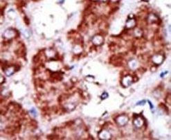 CPT1B Antibody in Immunohistochemistry (IHC)