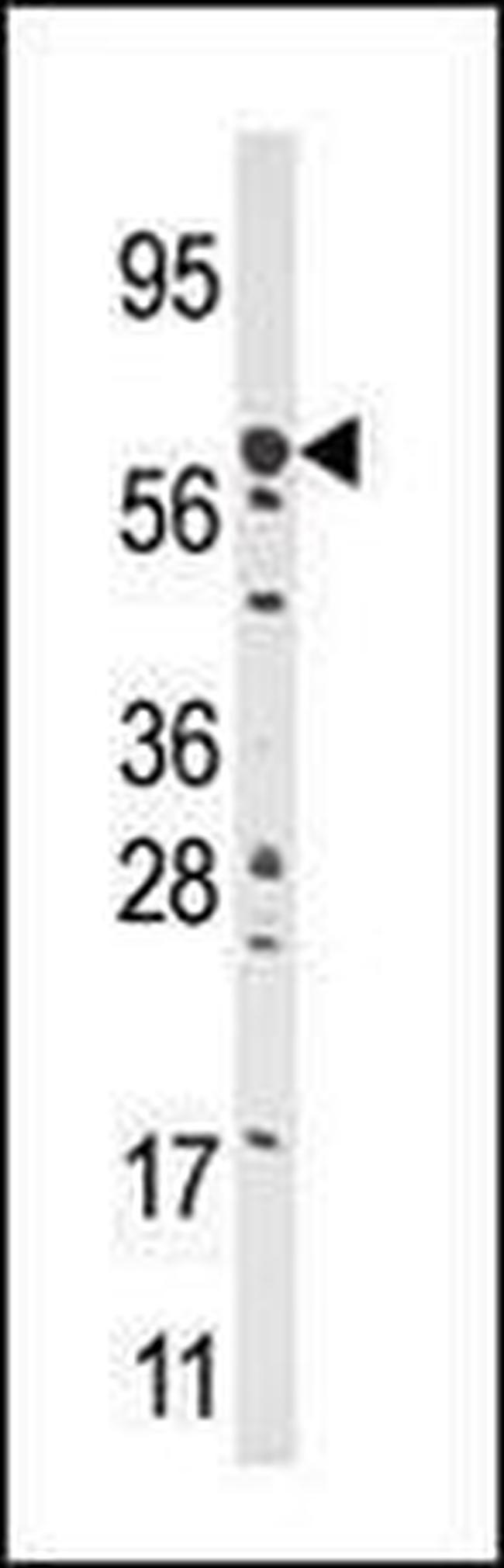 CPT2 Antibody in Western Blot (WB)