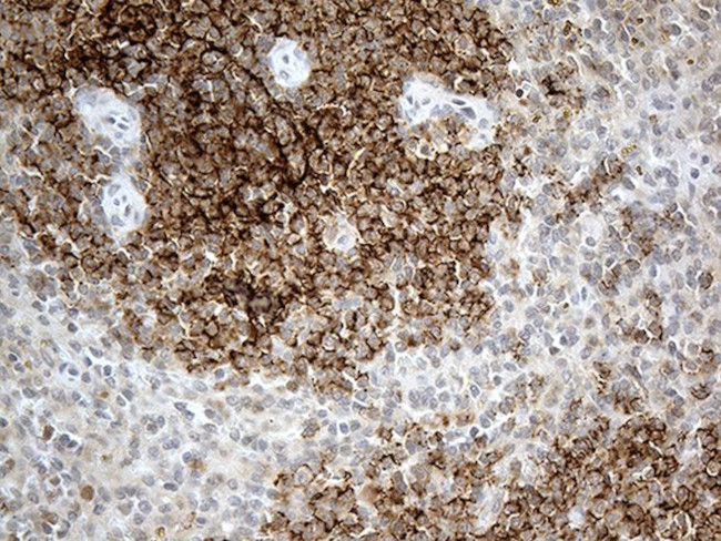 CR1 Antibody in Immunohistochemistry (Paraffin) (IHC (P))