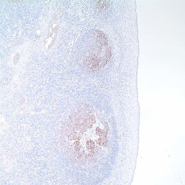 CD21 Antibody in Immunohistochemistry (IHC)