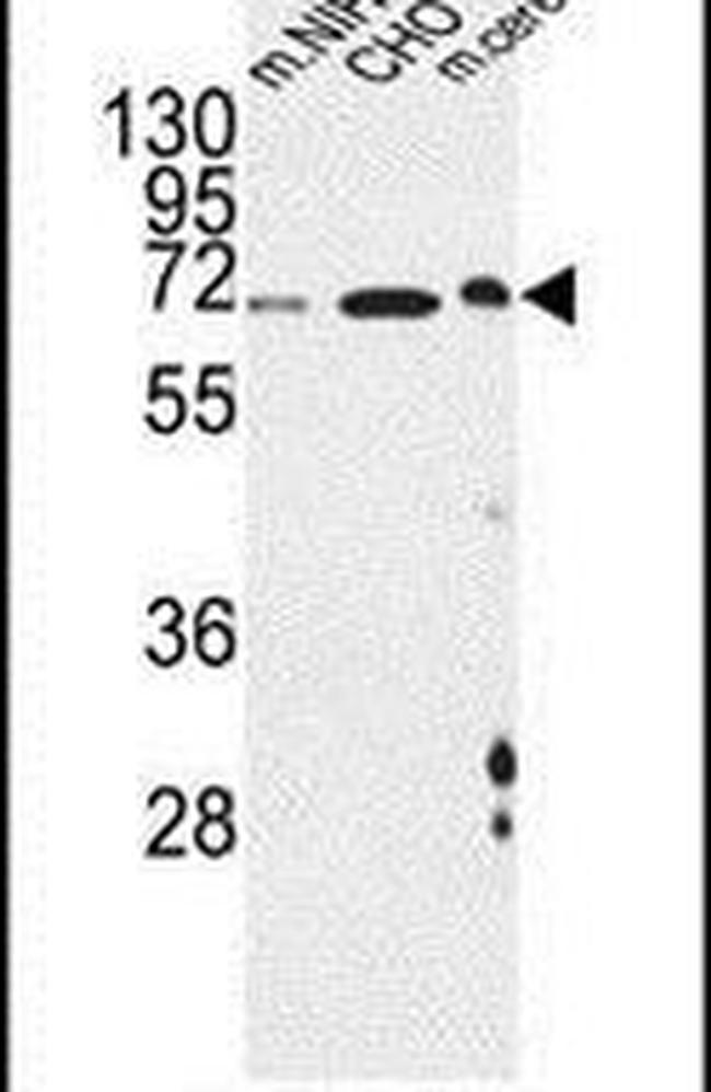 ATF6-beta Antibody in Western Blot (WB)
